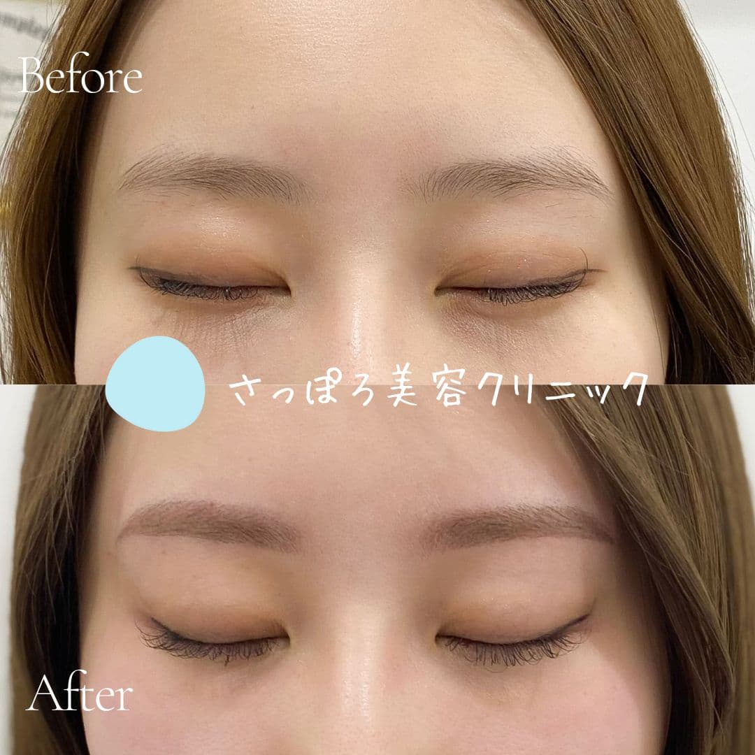 眉毛アートメイク