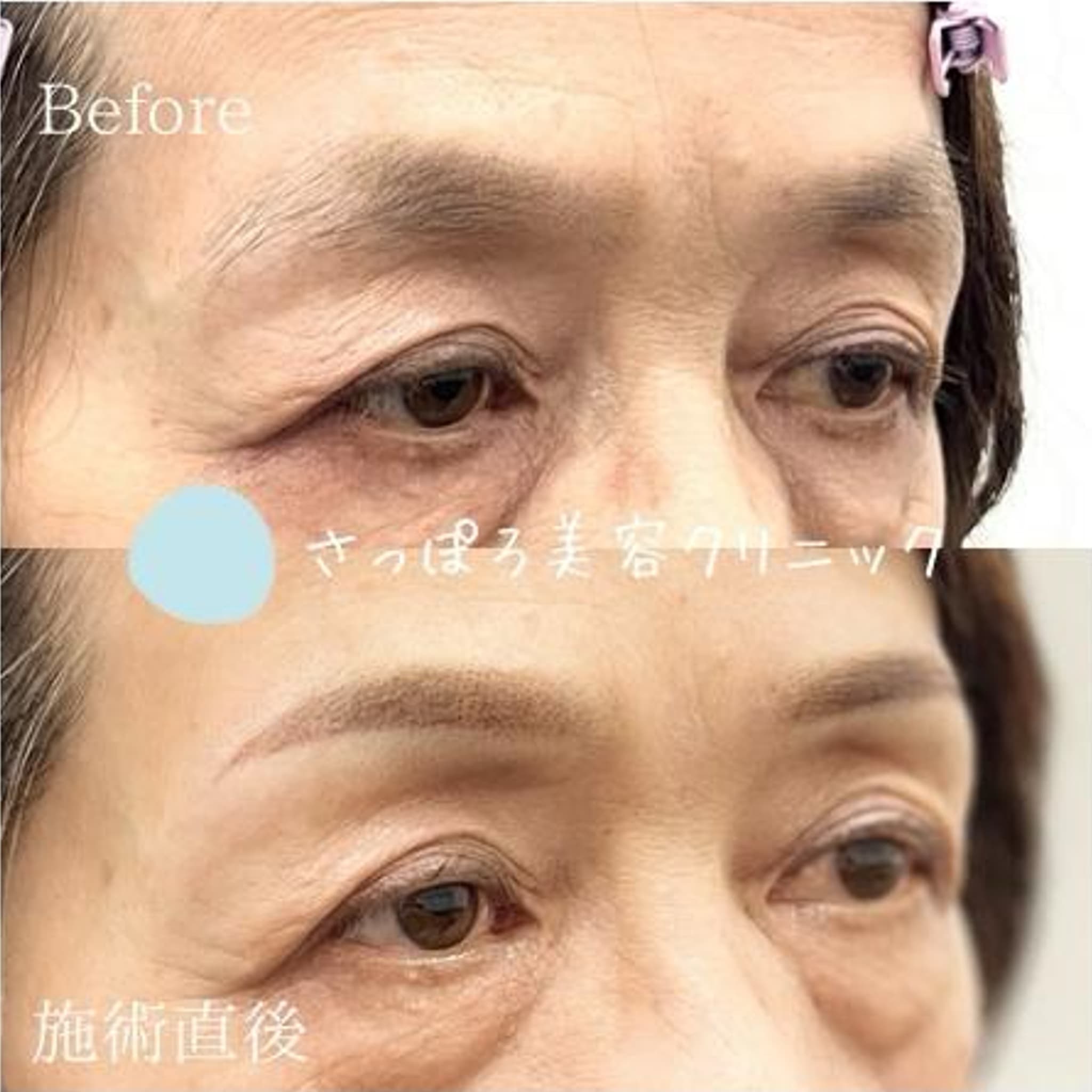 眉毛アートメイク