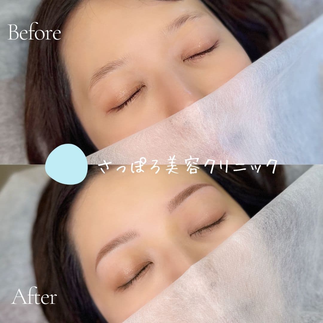 眉毛アートメイク