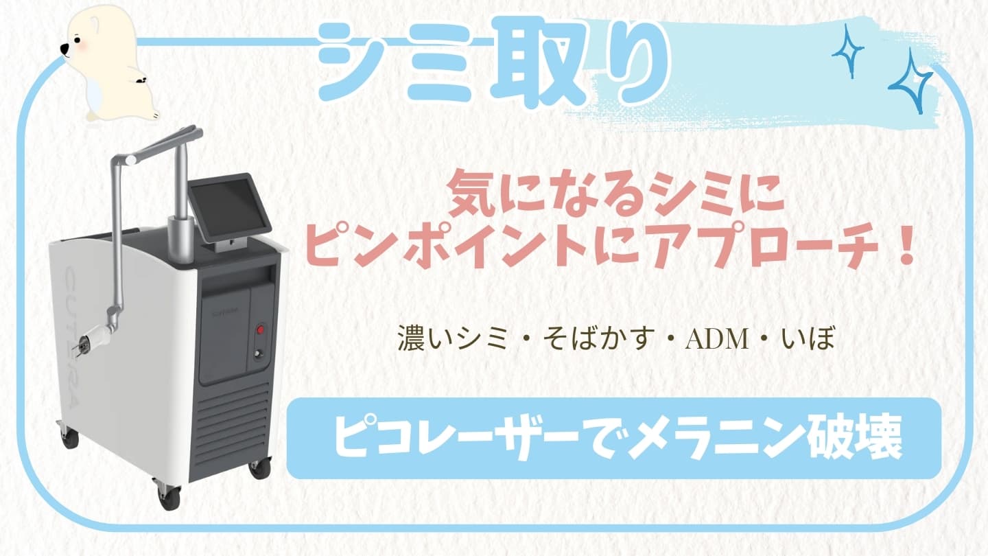 シミ取り (ピコスポット)