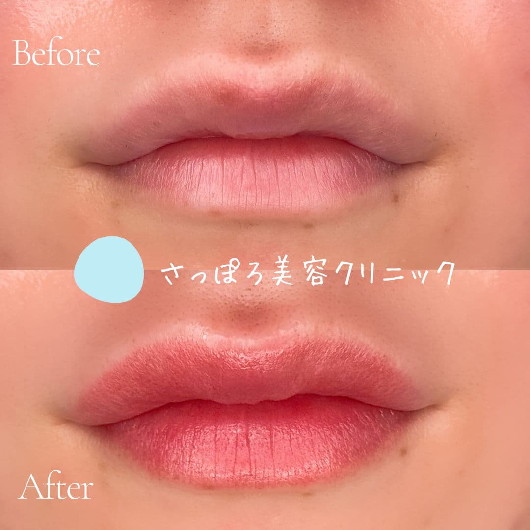 リップアートメイク